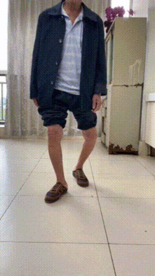 国汇策略 绵阳市骨科医院为复杂骨缺损患者开展机器人辅助下膝关节置换术